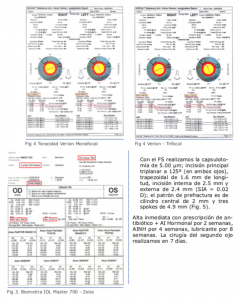 Femto para todos los casos | Alaccsa-R